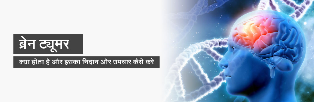 ब्रेन ट्यूमर: क्या  होता है और इसका निदान और उपचार कैसे करे